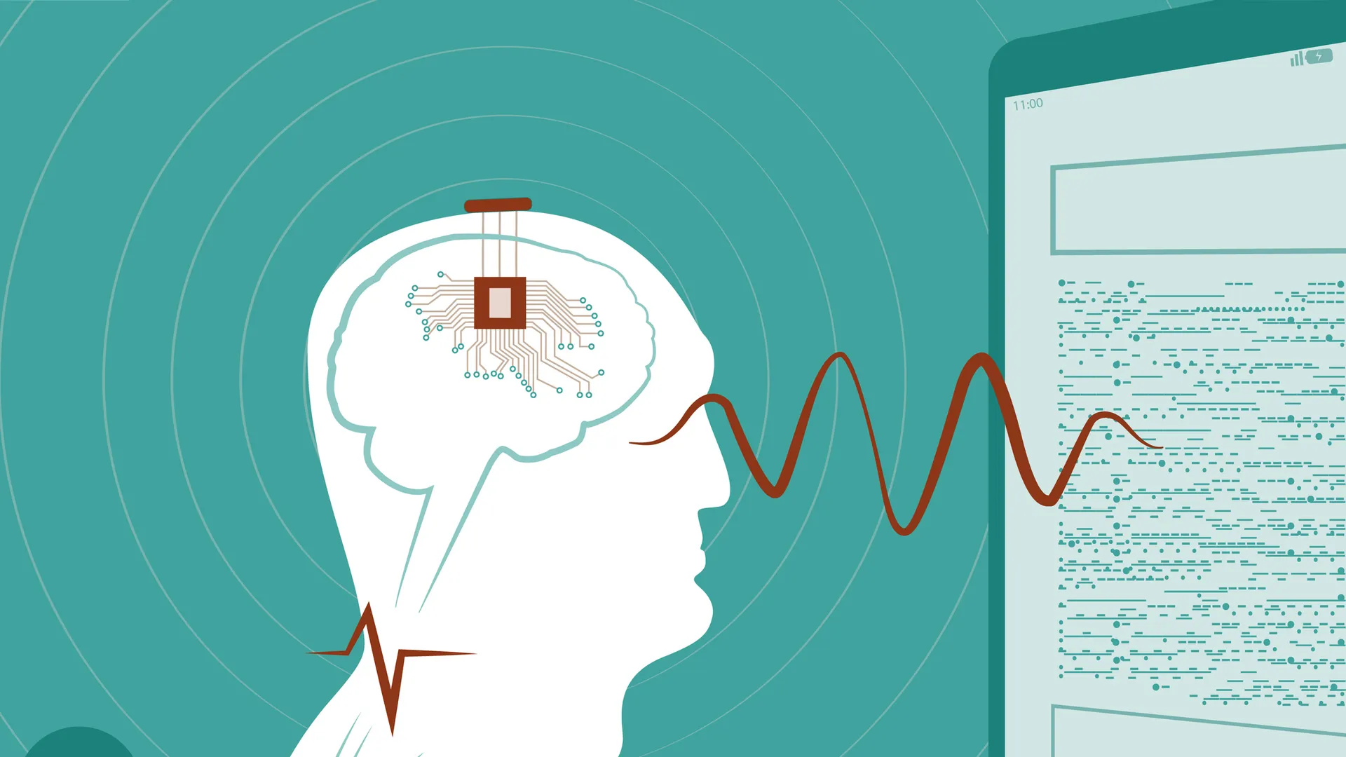 Chip cerebral NEO de Neuracle Medical Technology aprobado en China